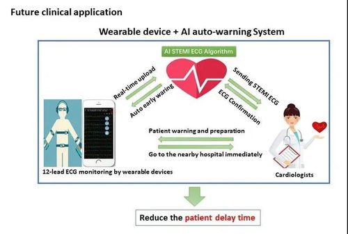 人工智能護(hù)航心臟健康 附屬十院徐亞偉團(tuán)隊(duì)研發(fā)全球首個(gè)心肌梗死人工智能預(yù)警系統(tǒng)